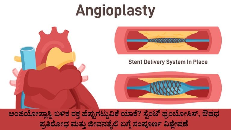 ಆಂಜಿಯೋಪ್ಲಾಸ್ಟಿ ಬಳಿಕ ರಕ್ತ ಹೆಪ್ಪುಗಟ್ಟುವಿಕೆ ಯಾಕೆ?